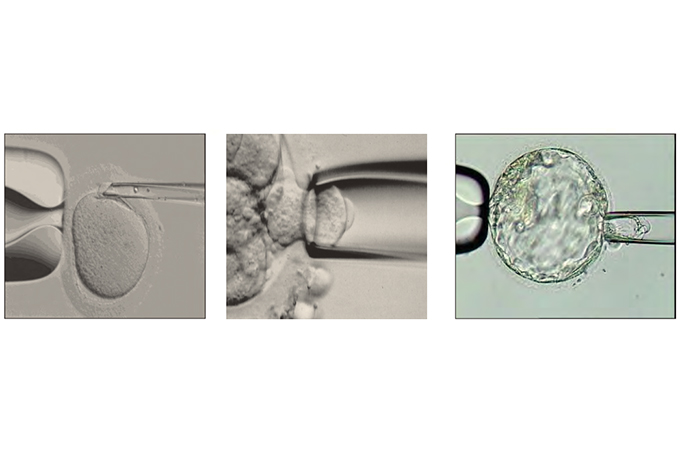 preimplantation genetic screening