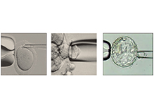 Tandem Mass Spectrometry Screening for Genetic Metabolic Diseases